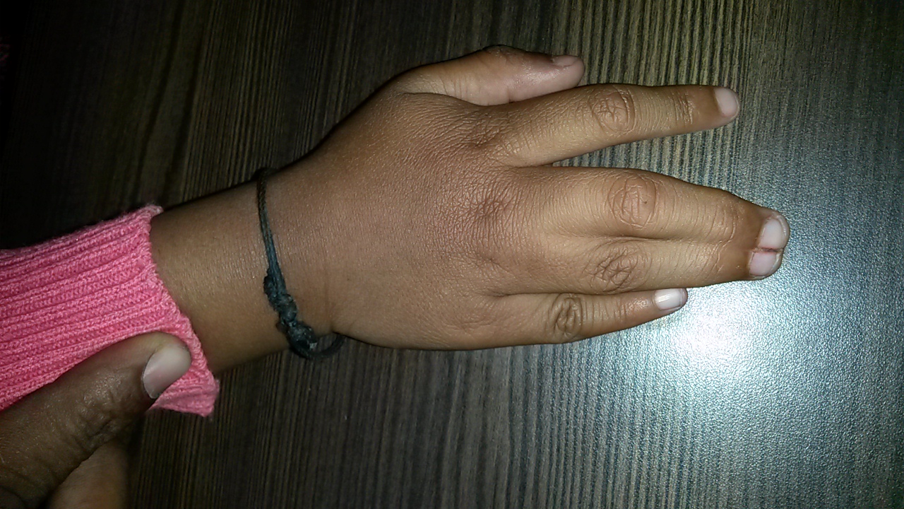 Pediatric Plastic Surgery Image 2